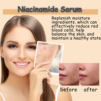 Hot  Facial Serum Oil - Anti-Wrinkle Moisturizing Repair Essence Oil Nourish Skin Reduce Fine Lines 2026 New BlemishLess