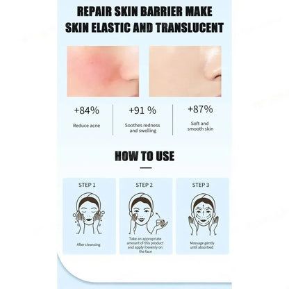 Face Serum Fruit Acid Acne Treatment Oil Control Remove Blackheads Shrink Pores Skin Texture Improve Care