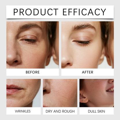 Upgrade Oligopeptide Face Skin Repair Micro Needle Serum Sensitive Skin Moisturizing and Smoothing Hyaluronic Acid Essence BlemishLess