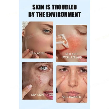 Face Serum Fruit Acid Acne Treatment Oil Control Remove Blackheads Shrink Pores Skin Texture Improve Care