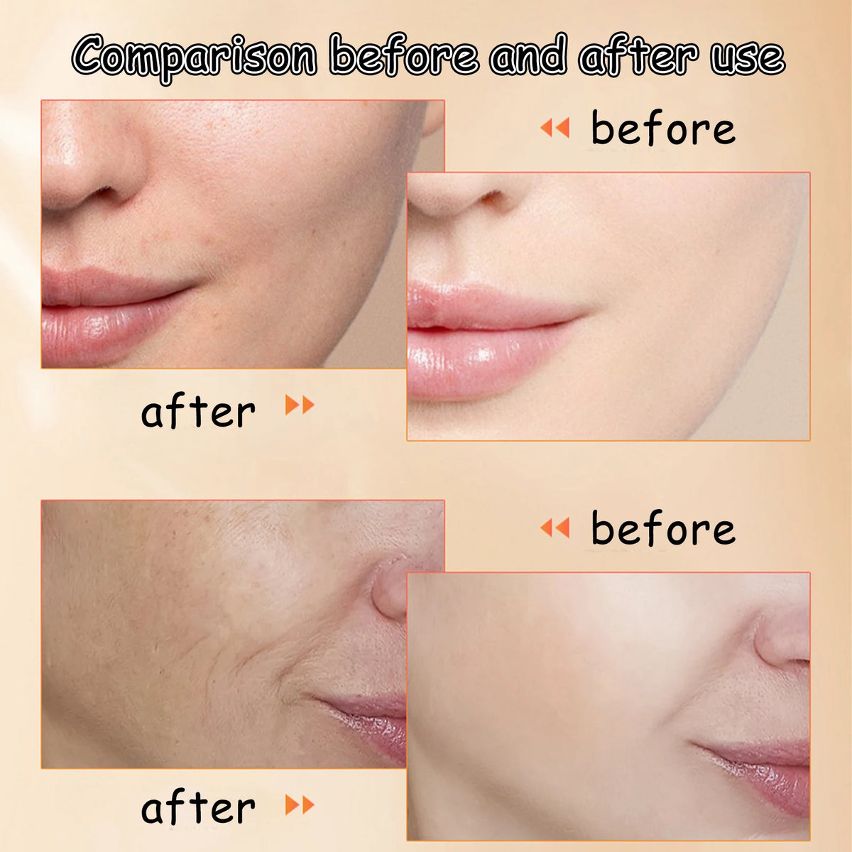 Hot  Facial Serum Oil - Anti-Wrinkle Moisturizing Repair Essence Oil Nourish Skin Reduce Fine Lines 2026 New BlemishLess