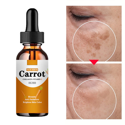 Carrot Essence Dark Spot Corrector Serum