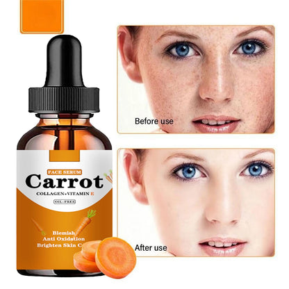 Carrot Essence Dark Spot Corrector Serum